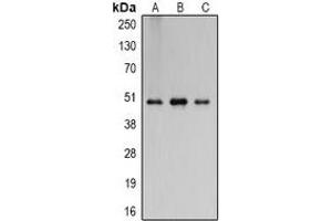 Western blot analysis of Flotillin 2 expression in A431 (A), mouse brain (B), rat brain (C) whole cell lysates. (Flotillin 2 抗体)