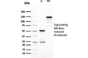 SDS-PAGE Analysis Purified HER-2 Mouse Monoclonal Antibody (ERBB2/3079). (ErbB2/Her2 抗体  (AA 311-462))