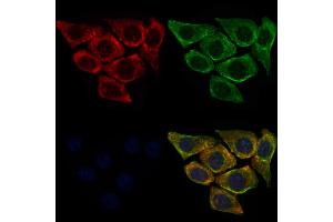 ABIN6260556 and ABIN6272680 staining HepG2 cells by IF/ICC. (CCR3 抗体  (C-Term))
