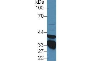 Western Blot; Sample: Rat Lung lysate; ;Primary Ab: 1µg/ml Rabbit Anti-Rat ANXA3 Antibody;Second Ab: 0. (Annexin A3 抗体  (AA 19-154))