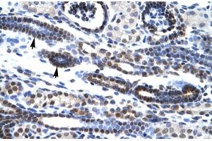 Rabbit Anti-HES7 Antibody Catalog Number: ARP30035 Paraffin Embedded Tissue: Human Kidney Cellular Data: Epithelial cells of renal tubule Antibody Concentration: 4. (HES7 抗体  (Middle Region))