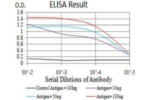 Black line: Control Antigen (100 ng), Purple line: Antigen(10 ng), Blue line: Antigen (50 ng), Red line: Antigen (100 ng), (Cytokeratin 5 抗体  (AA 258-357))