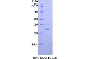 SDS-PAGE analysis of Mouse Paraoxonase 1 Protein. (PON1 蛋白)