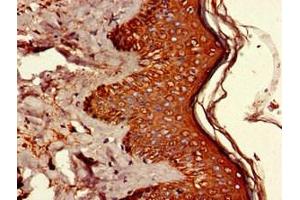Immunohistochemistry of paraffin-embedded human skin tissue using ABIN7174224 at dilution of 1:100 (Ubiquilin 1 抗体  (AA 1-300))