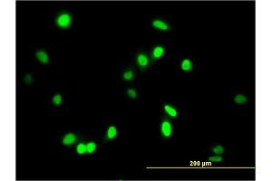 Immunofluorescence of monoclonal antibody to AATF on HeLa cell. (AATF 抗体  (AA 151-250))