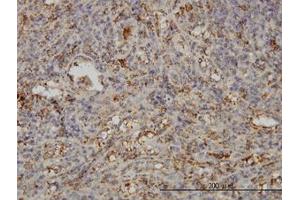 Image no. 1 for anti-Synaptosomal-Associated Protein, 23kDa (SNAP23) (AA 1-212) antibody (ABIN599065) (SNAP23 抗体  (AA 1-212))