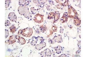 Formalin-fixed and paraffin embedded human larynx labeled with Rabbit Anti-MFSD2A Polyclonal Antibody, Unconjugated  at 1:200 followed by conjugation to the secondary antibody and DAB staining (MFSD2A 抗体  (AA 331-430))