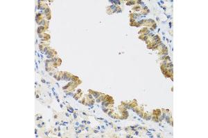 Immunohistochemistry of paraffin-embedded mouse lung using CDKN2C antibody (ABIN5971074) at dilution of 1/100 (40x lens). (CDKN2C 抗体)
