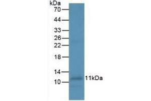 Detection of IL8 in Human Leukocyte Cells using Monoclonal Antibody to Interleukin 8 (IL8) (IL-8 抗体  (AA 23-101))