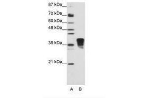 Image no. 2 for anti-Transformer 2 beta Homolog (TRA2B) (N-Term) antibody (ABIN202162) (TRA2B 抗体  (N-Term))