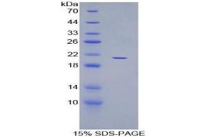 SDS-PAGE (SDS) image for ADAM Metallopeptidase with thrombospondin Type 1 Motif, 12 (ADAMTS12) protein (ABIN3008052)