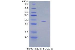 SDS-PAGE analysis of Human ADAMTS12 Protein. (ADAMTS12 蛋白)