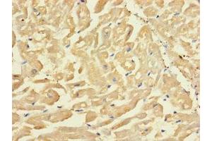 Immunohistochemistry of paraffin-embedded human heart tissue using ABIN7170255 at dilution of 1:100 (SLC43A3 抗体  (AA 209-278))
