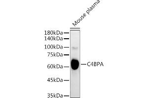 Western blot analysis of extracts of Mouse plasma, using C4BPA antibody (ABIN6134574, ABIN6137773, ABIN6137774 and ABIN6223565) at 1:3000 dilution. (C4BPA 抗体  (C-Term))