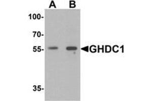 Western blot analysis of GHDC in 293 cell lysate with GHDC antibody at  (A) 0. (GHDC 抗体  (N-Term))