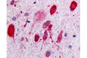 Anti-GPR171 antibody IHC of rat brain, neurons. (GPR171 抗体  (Cytoplasmic Domain))
