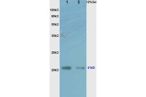 L1 human colon carcinoma lysates L2 rat brain lysates probed with Anti RhoA Polyclonal Antibody, Unconjugated (ABIN738846) at 1:200 overnight at 4 °C. (RhoA, C (AA 101-193) 抗体)