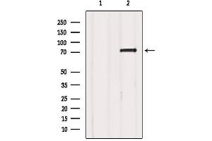 Western blot analysis of extracts from Mouse brain, using FXR1 Antibody. (FXR1 抗体  (Internal Region))
