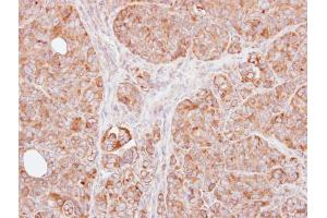 IHC-P Image Immunohistochemical analysis of paraffin-embedded SW480 xenograft, using TRAF1, antibody at 1:100 dilution. (TRAF1 抗体)