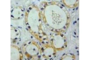 #VALUE! (Nephrin 抗体  (AA 39-144))