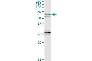 Immunoprecipitation of NEFL transfected lysate using anti-NEFL MaxPab rabbit polyclonal antibody and Protein A Magnetic Bead , and immunoblotted with NEFL purified MaxPab mouse polyclonal antibody (B01P) . (NEFL 抗体  (AA 1-543))
