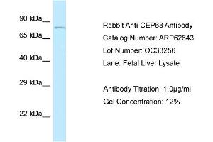 Western Blotting (WB) image for anti-Centrosomal Protein 68kDa (CEP68) (N-Term) antibody (ABIN2789197)