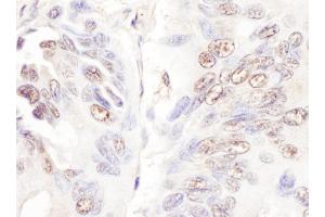 Immunohistochemistry (IHC) image for anti-Cyclin-Dependent Kinase-Like 5 (CDKL5) (AA 350-400) antibody (ABIN7453908) (CDKL5 抗体  (AA 350-400))