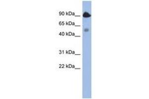 Image no. 1 for anti-BCL2-Like 13 (Apoptosis Facilitator) (BCL2L13) (AA 395-444) antibody (ABIN6744342) (BCL2L13 抗体  (AA 395-444))