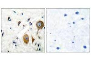 Immunohistochemical analysis of paraffin-embedded human brain tissue using GluR8 antibody. (GRM8 抗体)