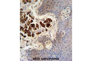 Immunohistochemistry (Paraffin-embedded Sections) (IHC (p)) image for anti-Collagen, Type XIX, alpha 1 (COL19A1) (AA 151-178), (Chain alpha 1), (N-Term) antibody (ABIN951628)