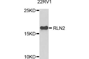 Western blot analysis of extracts of 22Rv1 cells, using RLN2 antibody. (Relaxin 2 抗体)
