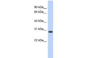 WB Suggested Anti-HOXD12 Antibody Titration:  0. (HOXD12 抗体  (Middle Region))