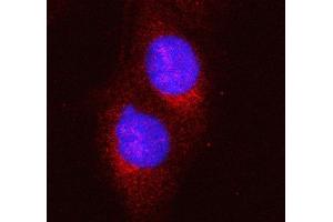 IF analysis of HERC5 using anti-HERC5 antibody (ABIN6719405).