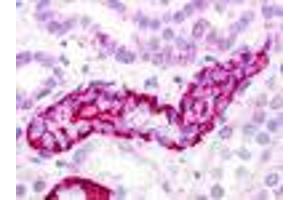 Anti-GPRC5D antibody IHC of human kidney, renal tubule. (GPRC5D 抗体  (Extracellular Domain))