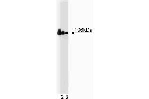 Western blot analysis of Adaptin beta on a Jurkat cell lysate (Human T-cell leukemia, ATCC TIB-152) (left). (AP2B1 抗体  (AA 75-245))