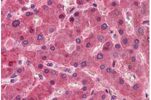 Liver, Human: Formalin-Fixed, Paraffin-Embedded (FFPE) (F12 抗体)