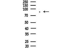 anti-Plakophilin 3 (PKP3) (C-Term) antibody