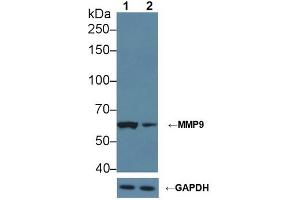 Western Blotting (WB) image for anti-Matrix Metallopeptidase 9 (Gelatinase B, 92kDa Gelatinase, 92kDa Type IV Collagenase) (MMP9) (AA 226-391) antibody (ABIN7432019)