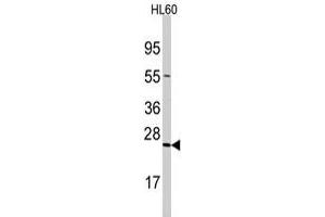Western blot analysis of TRAPPC4 polyclonal antibody  in HL-60 cell line lysates (35 ug/lane). (TRAPPC4 抗体  (N-Term))