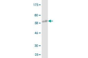 Western Blot detection against Immunogen (61. (Annexin A3 抗体  (AA 1-323))
