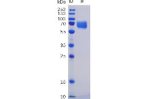 SDS-PAGE (SDS) image for CD84 (CD84) (AA 22-225) protein (mFc-His Tag) (ABIN6961120)