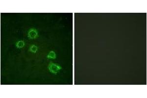 Immunofluorescence analysis of HuvEc cells, using c-PLA2 (Ab-505) Antibody. (C-PLA2 (AA 471-520) 抗体)