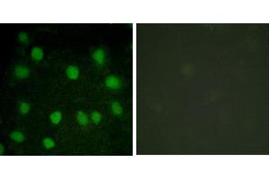 serum + -Immunofluorescence analysis of HuvEc cells, treated with serum (20%, 30mins), using Dematin (Ab-403) antibody. (Dematin 抗体  (Ser403))