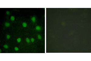 serum + -Immunofluorescence analysis of HuvEc cells, treated with serum (20%, 30mins), using Dematin (Ab-403) antibody.