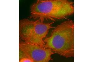Immunofluorescence (IF) image for anti-Meckel Syndrome, Type 1 (MKS1) (AA 90-124) antibody (ABIN6244194)