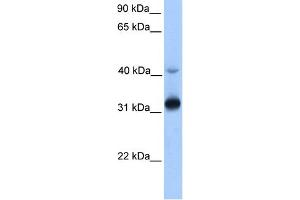 WB Suggested Anti-GPSN2 Antibody Titration:  0. (TECR 抗体  (Middle Region))