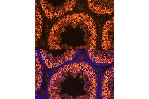 Immunofluorescence analysis of Mouse testis cells using PIWIL1 antibody (ABIN3023049, ABIN3023050, ABIN3023051 and ABIN6219364) at dilution of 1:100. (PIWIL1 抗体)