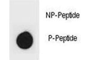 Dot blot analysis of phospho-IKK beta antibody.