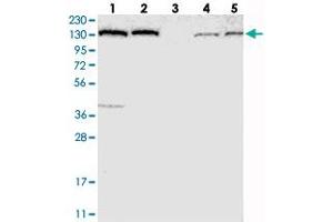 Western blot analysis of Lane 1: RT-4, Lane 2: U-251 MG, Lane 3: Human Plasma, Lane 4: Liver, Lane 5: Tonsil with PFAS polyclonal antibody  at 1:250-1:500 dilution. (PFAS 抗体)