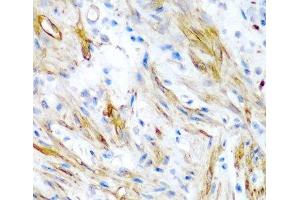 Immunohistochemistry of paraffin-embedded Human colon using LMOD1 Polyclonal Antibody at dilution of 1:200 (40x lens). (Leiomodin 1 抗体)